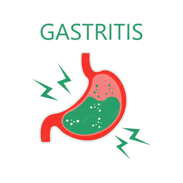 Atrophic Gastritis